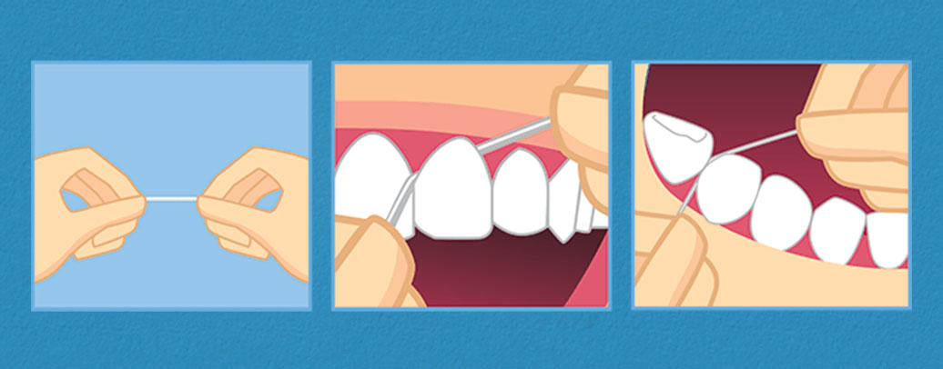 نحوه صحیح نخ دندان کشیدن